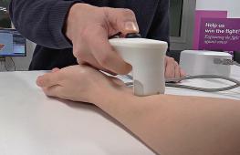 Технологию из детских игрушек использовали в датчике для анализа экземы