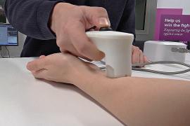 Технологию из детских игрушек использовали в датчике для анализа экземы