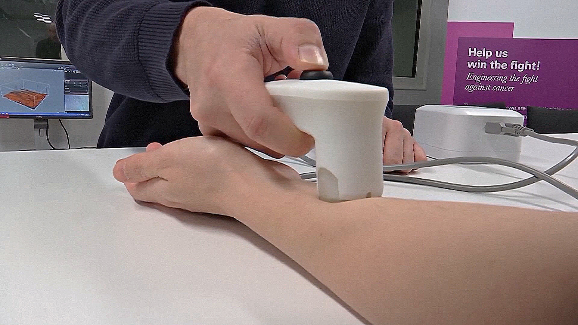 Технологию из детских игрушек использовали в датчике для анализа экземы