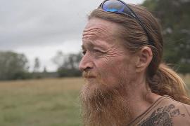 Смертельная аллергия после укуса клеща зафиксирована в Австралии