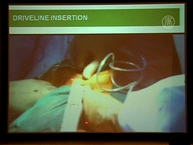 Индия: первая операция по вживлению насоса сердца Индия: первая операция по вживлению насоса сердца