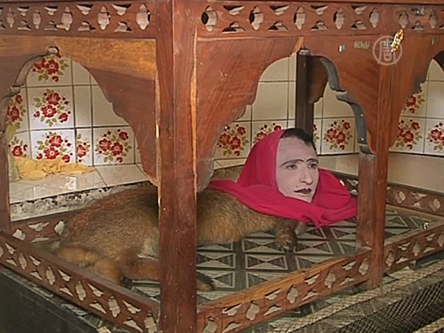 Человек-лиса живёт в зоопарке Пакистана
