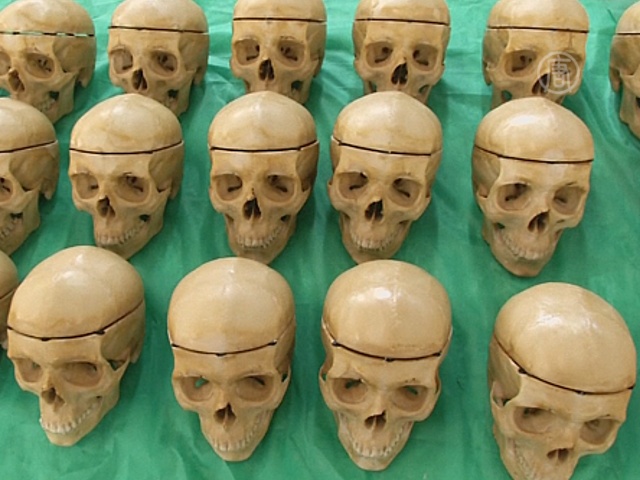 Синтетические кости уже 19 лет делают в Мексике