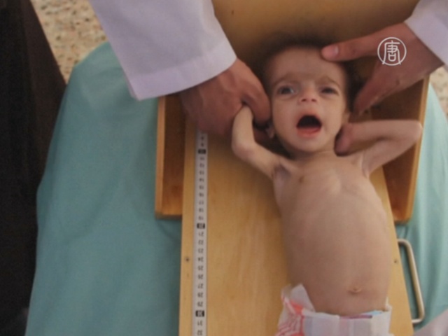 Дети в Сирии всё больше недоедают