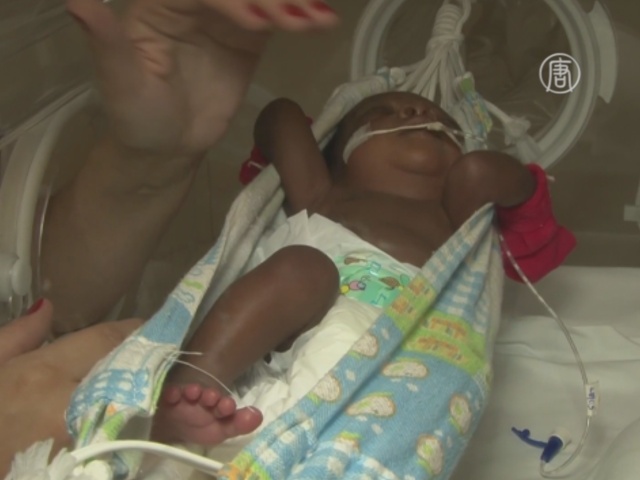 В Бразилии недоношенных детей помещают в гамаки