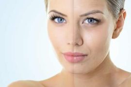 Мезонити – новая технология красоты